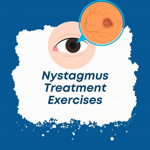 Nystagmus Treatment Exercises  | Dr. Trish Leigh