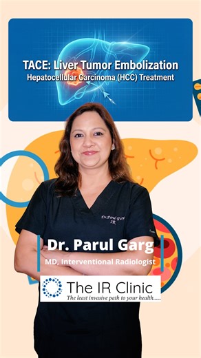Dr Parul Garg | 🟡 Liver Tumor (HCC) Treatment: TACE Case — Step-by-Step In this reel, Dr. Parul Garg showcases a real TACE (Transarterial... | Instagram