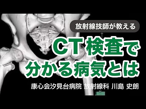 放射線技師が教えるCT検査で分かる病気とは