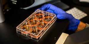 Certain Biotech Investors Get an Early Look at Results. Is That Fair?