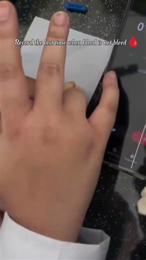 To determine the bleeding time (BT) ||Bleeding time ||HAPlab||#test #laboratory#trending #experiment