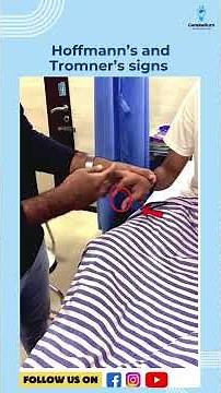 Hoffmann’s and Tromner’s signs | Dr. Dilip Kumar #neetpg2025 #inicet