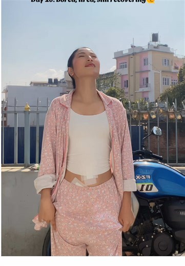 Day 10 of Recovery from Appendix Surgery