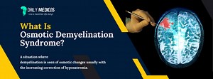 Osmotic Demyelination Syndrome: All You Need To Know - Daily Medicos
