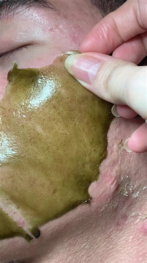 Essential Tips for Skin Care in Your 30s