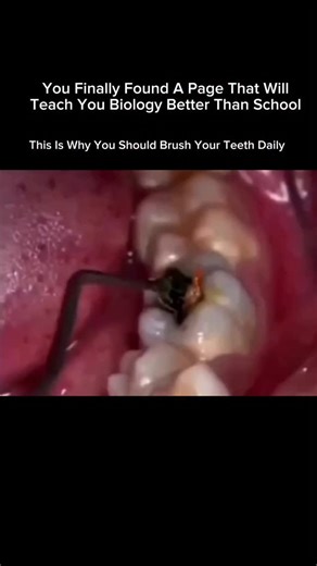 Explaining Biology on Instagram: "Why You Should Brush Your Teeth Daily 🪥 Brushing your teeth every day is essential for good health, not just a bright smile. When you eat, food particles stay in your mouth and mix with bacteria to form plaque. If plaque isn’t removed, it can cause cavities, gum disease, bad breath, and even tooth loss. Daily brushing helps: Remove plaque and bacteria Prevent cavities and tooth decay Keep gums healthy and strong Freshen breath Maintain a clean, confident smile 