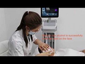 Thermage training video - YouTube