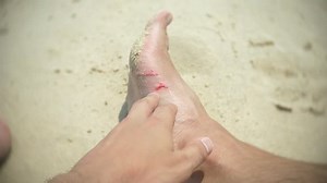 clip-1008003556-human-feet-cut-about-corals-while-swimming
