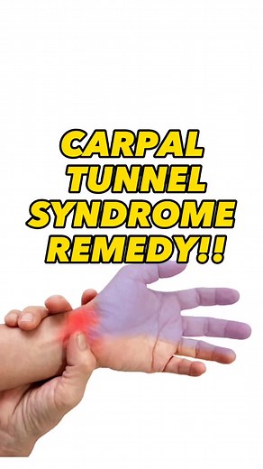2.6M views · 34K reactions | Carpal tunnel syndrome (CTS) is pressure on a nerve in your wrist. It causes tingling, numbness and pain in your hand and fingers. #carpaltunnelsyndrome #carpaltunnel #hand #wristpain #physicaltherapysession #foryou #foryoureels #trendingreels | Physical Therapy Session | Facebook
