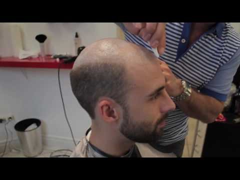 Le Remplacement Capillaire à La Clinique Capillaire de Montréal CheveuxCool.com