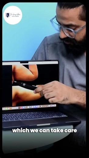 Case 12/50: Decoded by Dr Umang Kothari Full Arm Lift - Mini Arm Lift