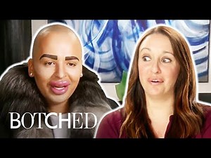 Top 5 Botched Lip LEGENDS | E!