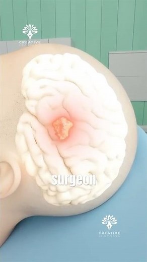 How a Brain Tumor Is Removed😮