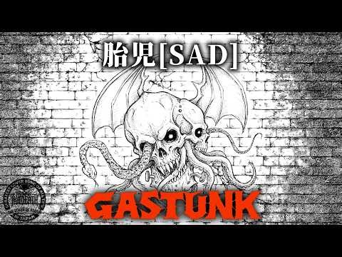 胎児SAD