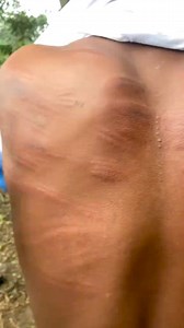 A student of Toase Senior High School in the Ashanti Region has taken to social media to share photos and videos of bruises on his back, allegedly caused by severe beatings from a teacher. According to reports, the teacher assaulted him for failing to show up to write an exam. | Simon De Shiny