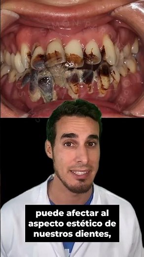 SMOKING TOBACCO and its effects on the HEALTH of your MOUTH and TEETH