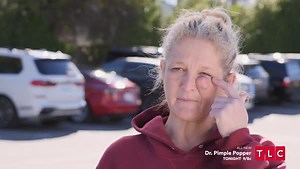 Dr. Lee counsels a patient desperate for relief, tonight at 9/8c on #DrPimplePopper | Dr. Pimple Popper
