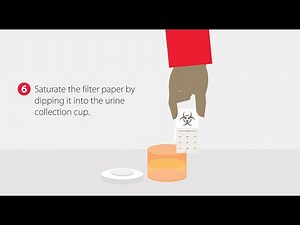 How to Collect a Dried Urine Sample | Step-by-Step Guide