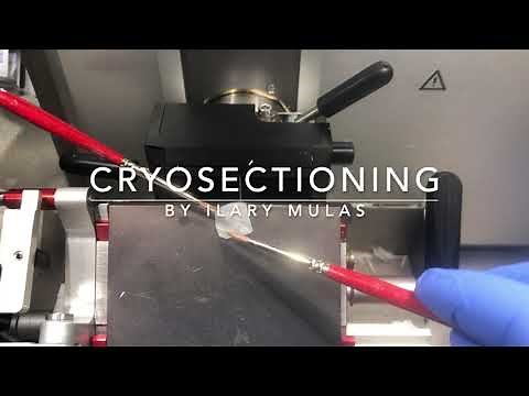 CRYOSECTIONING OCT embedded blocks of tissues