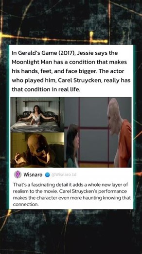 In Gerald's Game 2017 Jessie says the Moonlight Man has a condition that makes his body face bigger