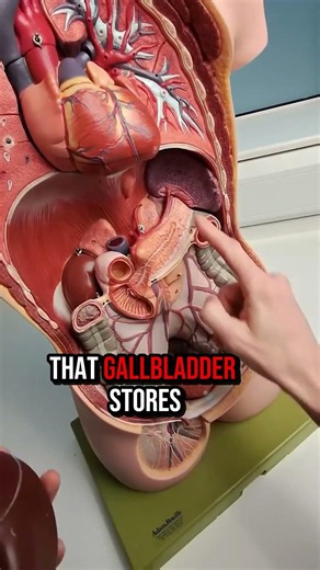 Gallbladder Stones #loveyourgut #healing #stressrelief