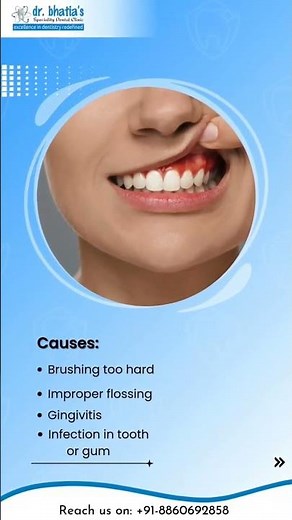 Bleeding Gums? Don’t Ignore the Warning Signs | Causes & Easy Solutions Explained
