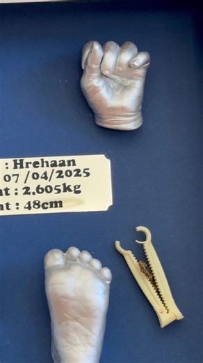 🍼 Because they’re only tiny once... Preserve those early days with a stunning 3D baby hand & foot casting 👣💗 A memory you’ll hold onto forever. 📧 Book your baby’s keepsake today! 📧 thelifecastingaus@gmail.com 📞 0401 638 450 #babycasting #handandfootcasting #3dkeepsake #babybonding #babyprints #lifecastinglove #custombabyart #timelessmemories #preciousmoments #firstyearcasting #babyhands #babyfeetlove #tinyhandsandfeet #cutebabycasting #capturedforever #babylove #babyart #personalisedbabyca