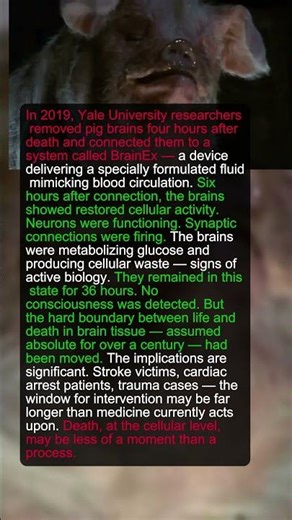 Scientists Kept a Brain Alive Outside a Body for 36 Hours. It Was Still Responding.