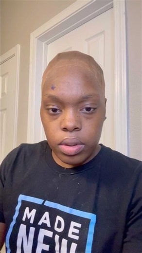 Wig Install Teaser 👀🔥 | Bald Wig Cap + Melted Lace Transformation #WigTutorial #WigTok #lace