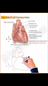 🆕 Visual: Left Coronary Artery (LCA) Branches This schematic details the LCA's origin from the left aortic sinus and its bifurcation: · Anterior Interventricular Artery (LAD): Descends in the anterior sulcus. Supplies the anterolateral myocardium via Diagonal Branches and the anterior septum via Anterior Septal Perforators. · Circumflex Artery (LCX): Courses in the left AV sulcus. Supplies the lateral left ventricle via the Left (Obtuse) Marginal Artery. Clinical Relevance: The LCA system is do