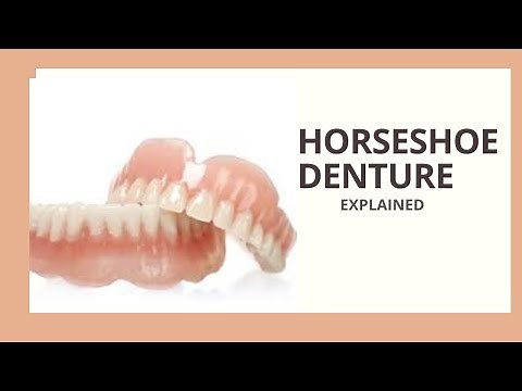 What is a "horseshoe denture" video