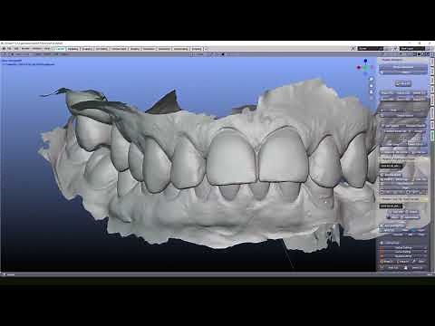 Blenderfordental - 3D print models for beginners