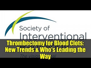 Thrombectomy for Blood Clots: New Trends & Who's Leading the Way