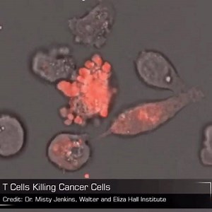3.7K views · 150 reactions | NK/T cell vs cancer cell. The immune system is amazing. #pathology #science. https://www.eurekalert.org/pub_releases/2016-05/waeh-ht052016.php #ASCP40underForty2017 | Jerad Gardner, MD | Facebook