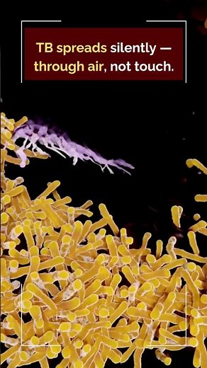 Tuberculosis (TB): Causes, Symptoms, Diagnosis & Treatment Explained