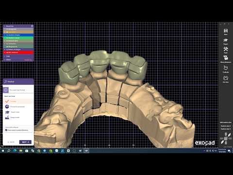 Exocad design cingulum rest