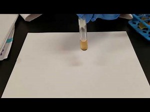 Urea Test