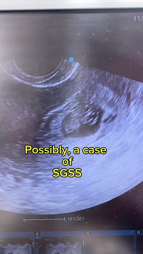 37K views · 235 reactions | Kapag may nakita ka sa ultrasound report...