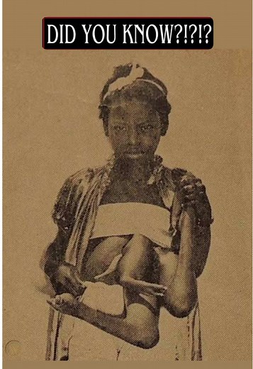 Today in Black Women’s History I researched ✨ Betty Lou Williams the “Four-Legged Girl” who turned her uniqueness into power. #circus #performers #twinsisters #historylesson