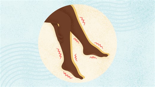 What Is Restless Legs Syndrome? Symptoms, Causes, Diagnosis, Treatment, and Prevention