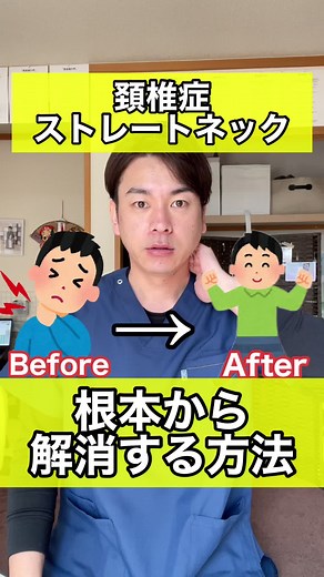 治らないと言われた頚椎症・ストレートネックを根本から解消する方法 #頚椎症 #頚椎ヘルニア #頚椎椎間板症 #ストレートネック改善 #ストレートネックの治し方 #ストレートネック#首こり
