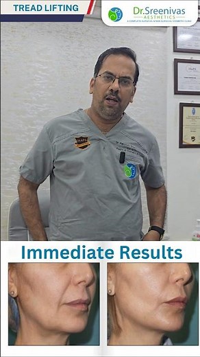 Know about Thread Lifting Procedure by Dr. Pavuluru Sreenivas Rao. #threadlifting #skinlifting