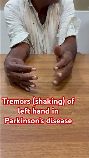 Tremors (shaking) of left hand in Parkinson’s disease