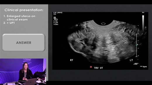 Weekly Ultrasound Training Spotlight from GCUS Presented by: Emily...
