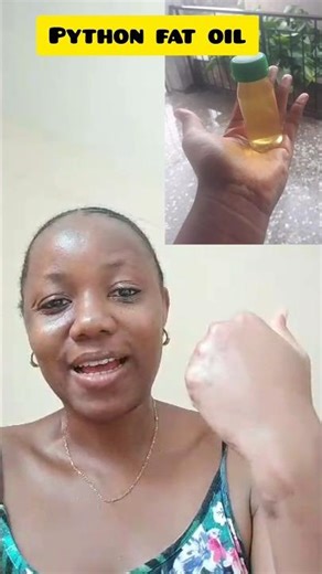 Keliod & Scar Care The Traditional Way. WhatsApp +2348092878311