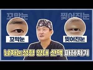 찢어진눈, 꼬막눈 이거면 고민 해결ㅣ남자눈매교정성형수술 전후 사진 파헤치기ㅣ안병준성형외과