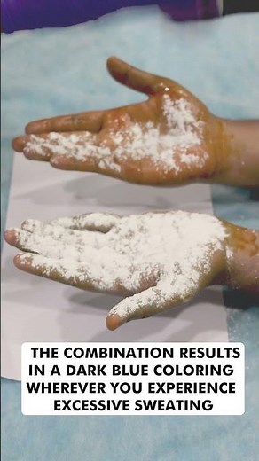 how to stop sweaty hands | sweaty hands solution | Botox Therapy | Skinaa Clinic viral #shorts