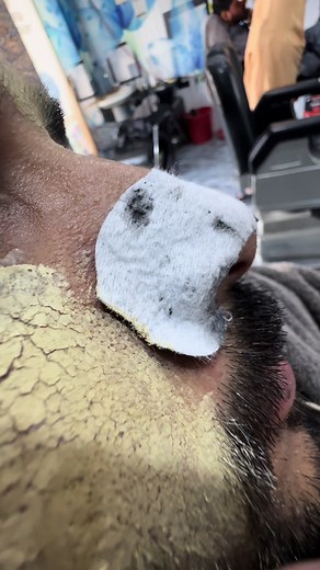 Effective Whitehead Treatment for Everyone