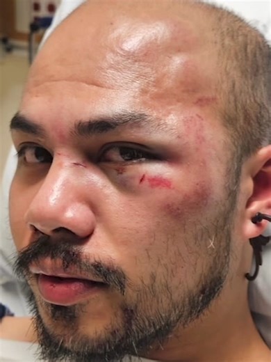 Good Samaritan Injured While Preventing Harassment