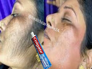 437K views · 2.6K reactions | Stop! Shaving the easy way to remove facial body and public hair without pain | Health Care Zone | Facebook